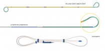 Фото Стент мочеточниковый Yellow-Star Tumor-Stent управляемый