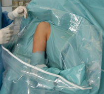 Фото Стерильное операционное белье Foliodrape® Protect Plus Shoulder Arthroscopy set I reinforced / Комплект для артроскопии плеча I усиленный «Фолиодрейп Протект Плюс» 5шт.упк, HARTMANN