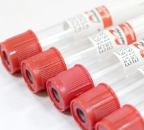 Фото Пробирка "IMPROVACUTER" для исследования сыворотки (без наполнителя) 9мл, 16х100мм, пластик, тип пробки SСA