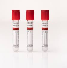 Фото Пробирка вакуумная Lab-Vac для взятия крови с активатором свертывания 9 мл, 16*100 мм (100шт/уп; 1200шт/кор) (ЧЗ)